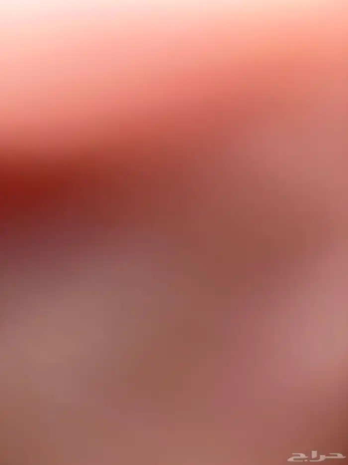 مطلوب شبوط في حصمه ولا لحد 0