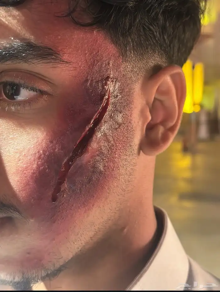 فن الجروح ورسم وجه 0