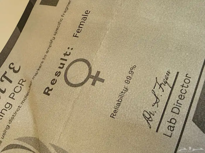 جوز كنيور قرين شيك 8