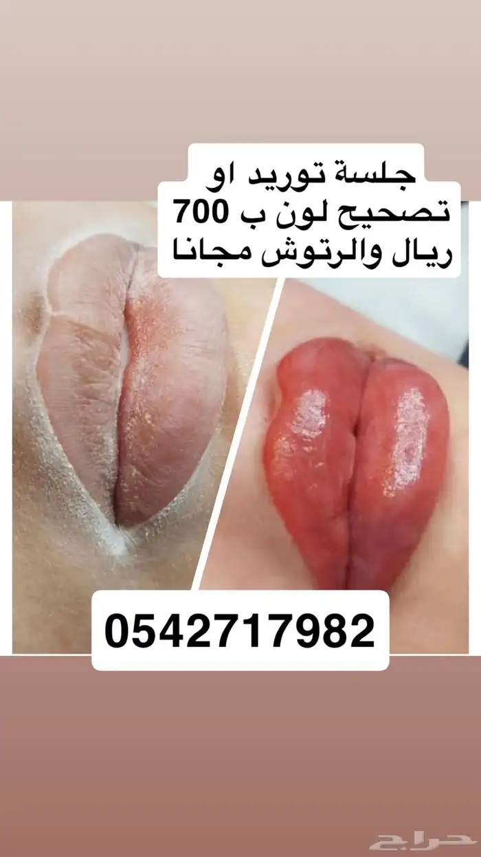 توريد شفايف 0