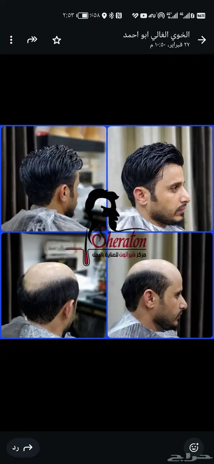 باروكات استرالي شبكيه درجه اولى 0