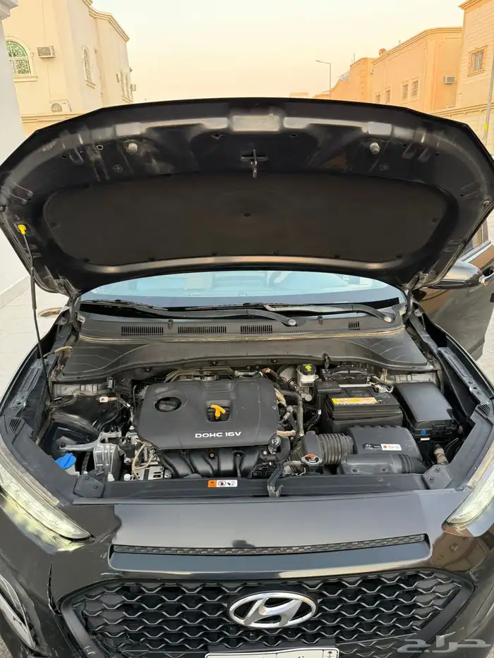 كونا اسود مصدومه صدمه خفييفه 2020 11