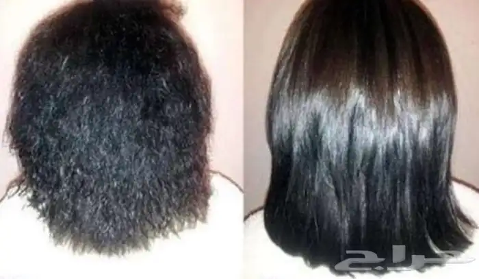 متخصصه علاجيه للشعر بالطائف 1