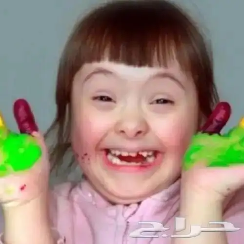 اخصائي تخاطب وتعديل سلوك وتوحد ومتلازمه داون 1