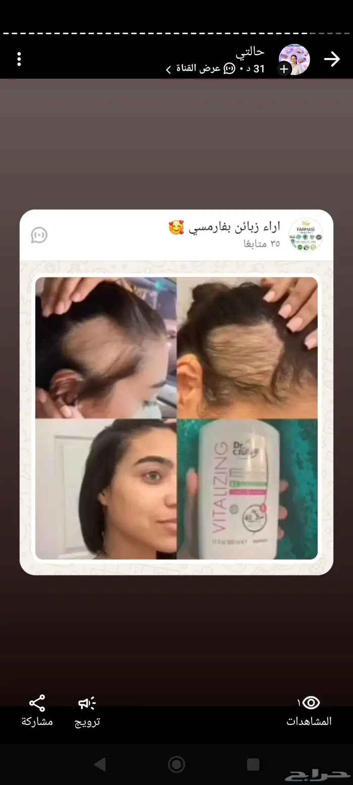 شامبو الثوم والكابيكسل لزراعة الشعر والتحكم بالدهون الفروة 4