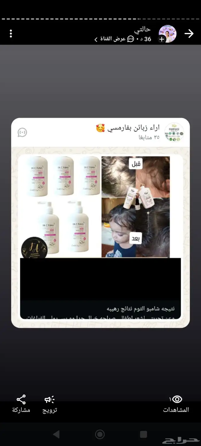 شامبو الثوم والكابيكسل لزراعة الشعر والتحكم بالدهون الفروة 1