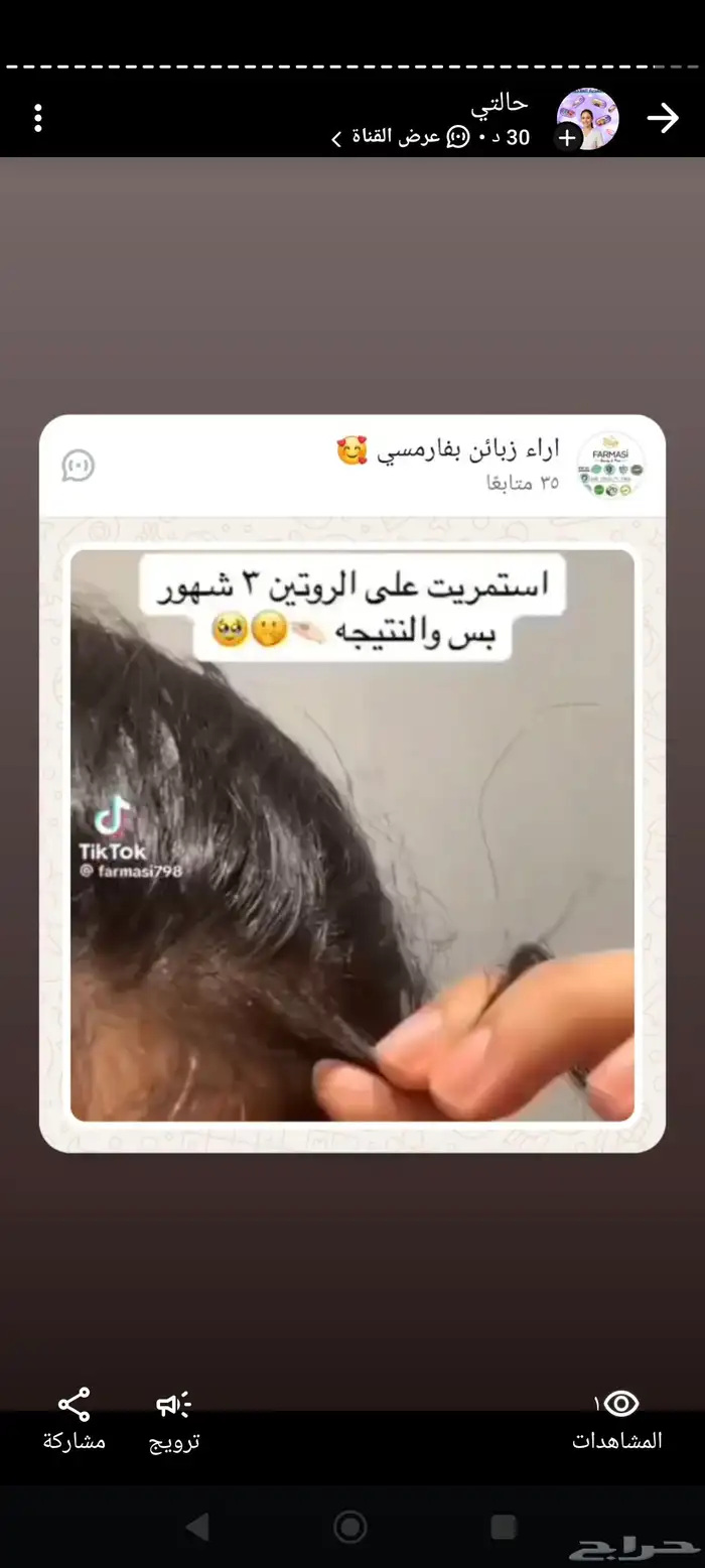 شامبو الثوم والكابيكسل لزراعة الشعر والتحكم بالدهون الفروة 2