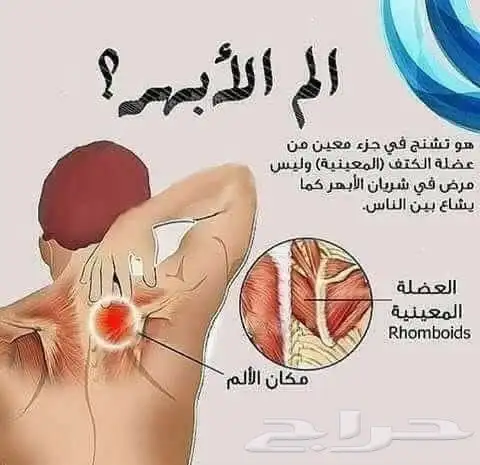 متخصص حجامة 0