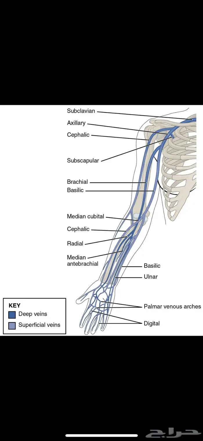 فصد عرق النسا وطريقة مسار العروق 1
