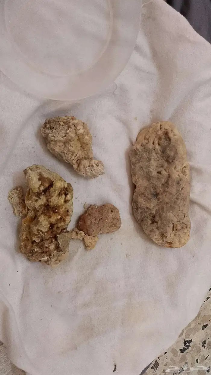 عنبر الحوت 2