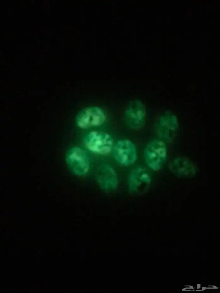 فيروز بعروق الذهب ومسباح مرجان عمره فوق 100 سنه 13