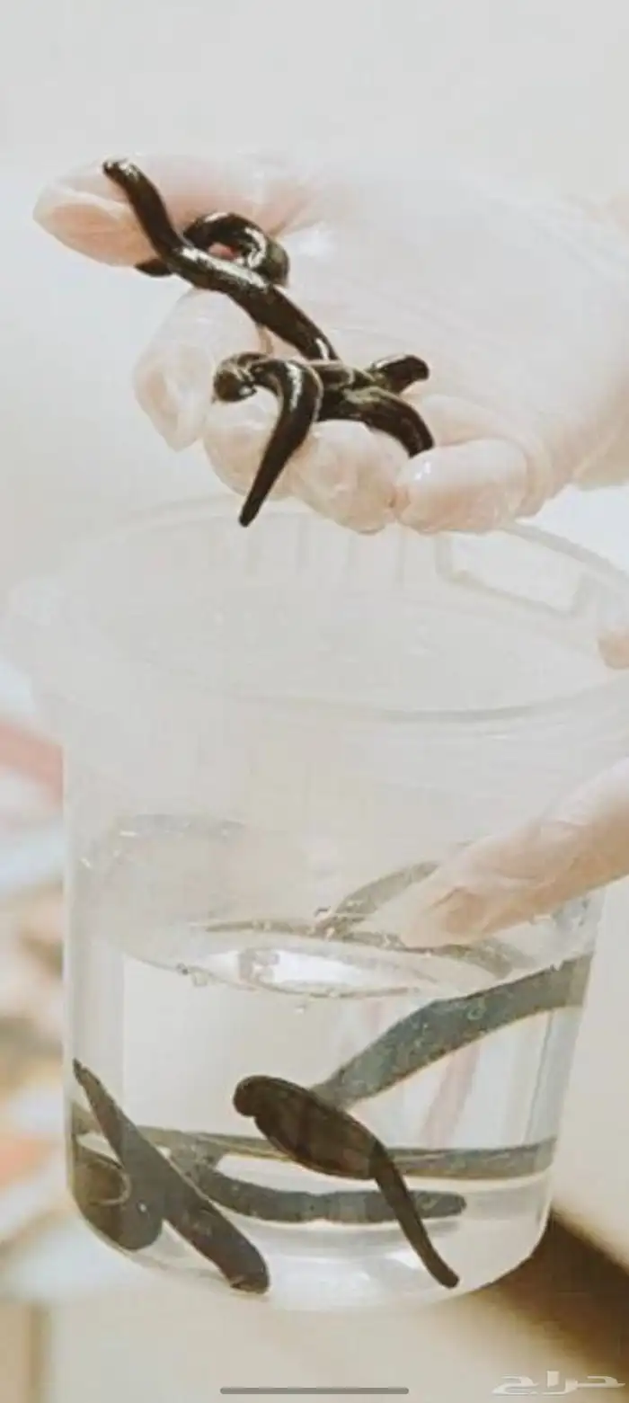 دودة العلق الحكيمه 0