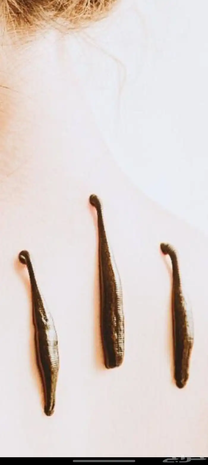 دودة العلق الحكيمه 1