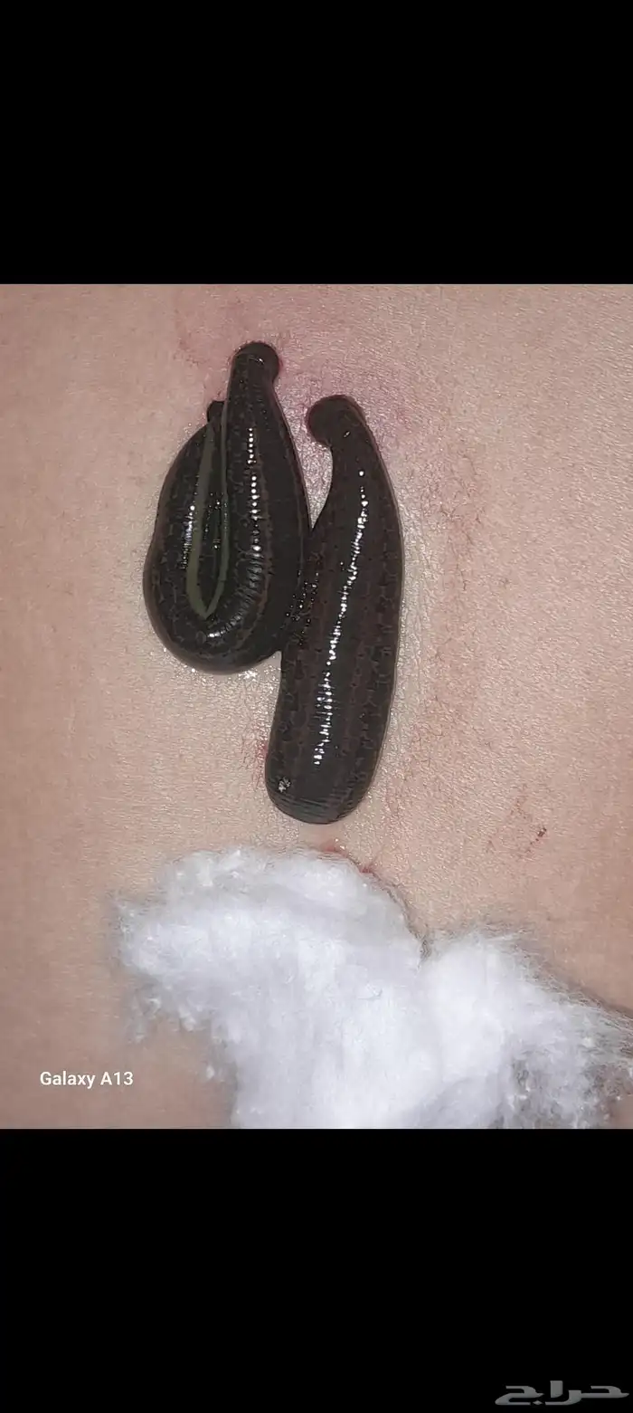 دودة العلق الحكيمه 3