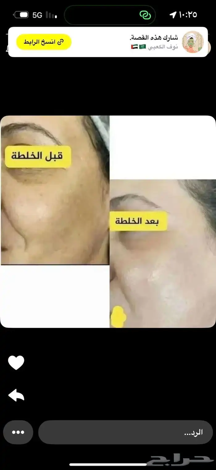 خلطات تبيض 1