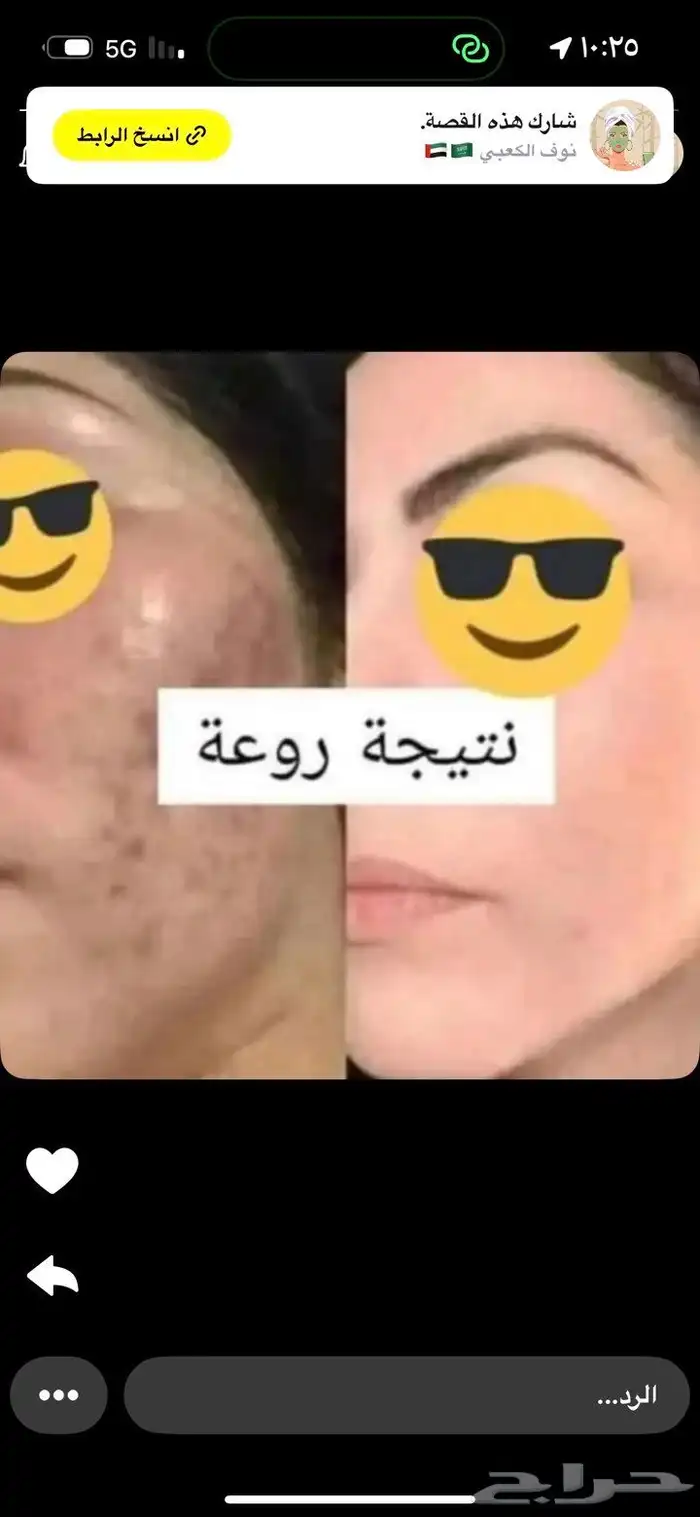 خلطات تبيض 0