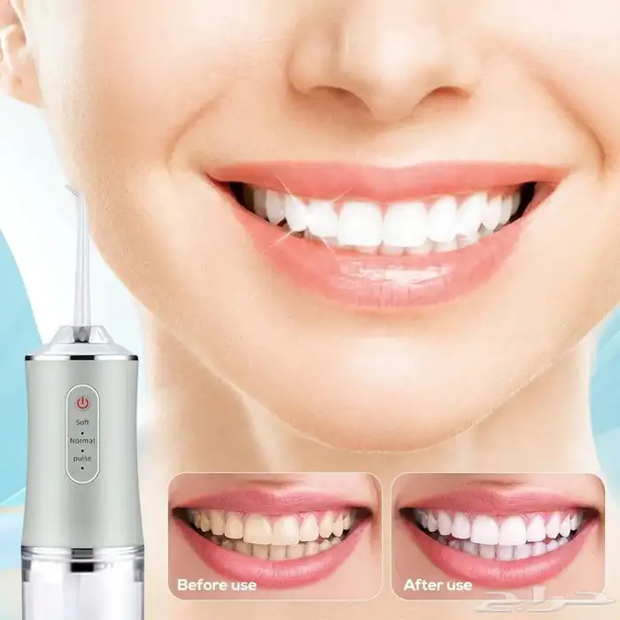 (خيط الأسنان المائي)جهاز تنظيف الأسنان بالماء 5