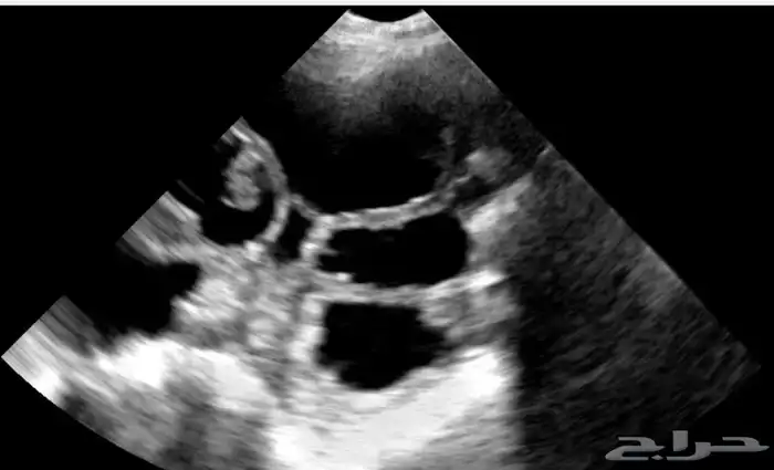 يوجد لدينا سونار وتتين الأغنام 1