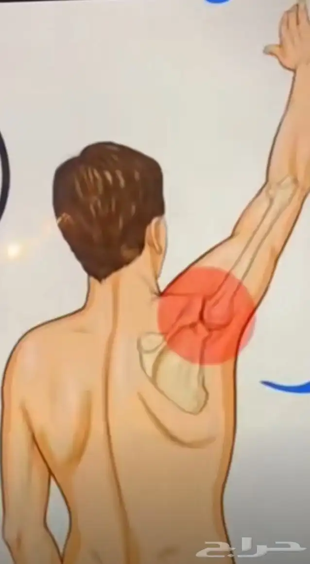 الشفاء للحجامة  التداوي بالمسنونة 9