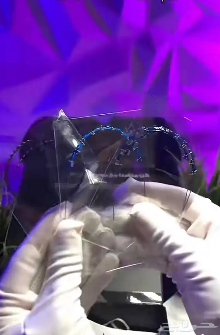 تقويم اسنان 2