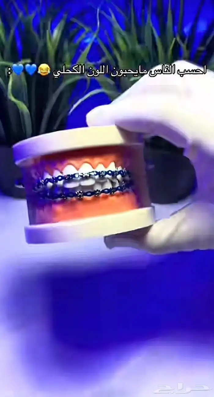 تقويم اسنان 1