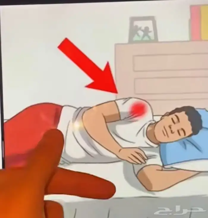 الشفاء للحجامة  التداوي بالمسنونة 8