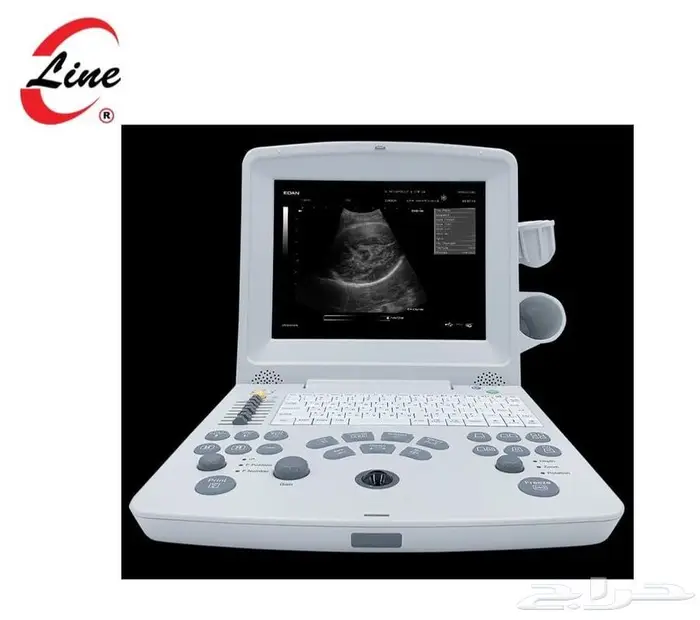 سونار كشف حمل ومشاكل الحمل في الإبل والبقر والخيل 0