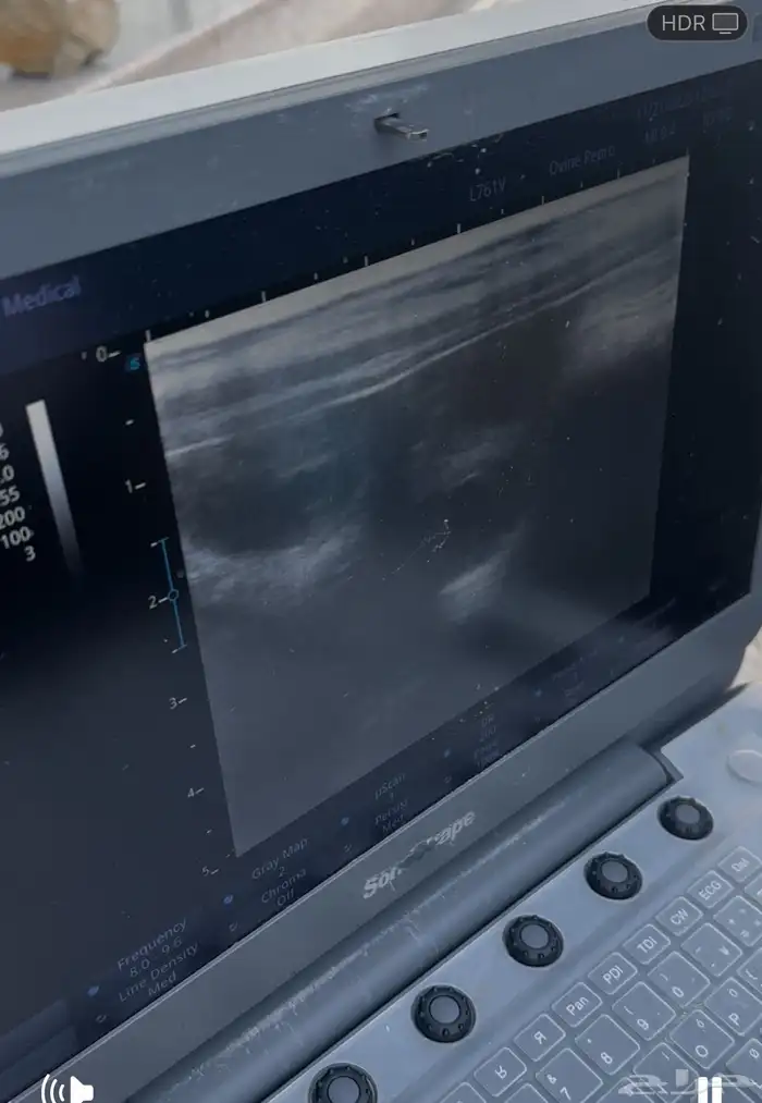 عنز دافع بثنين جبره وطيبه جدا منوة القناي 4