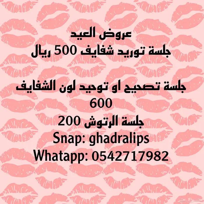 توريد شفايف 0