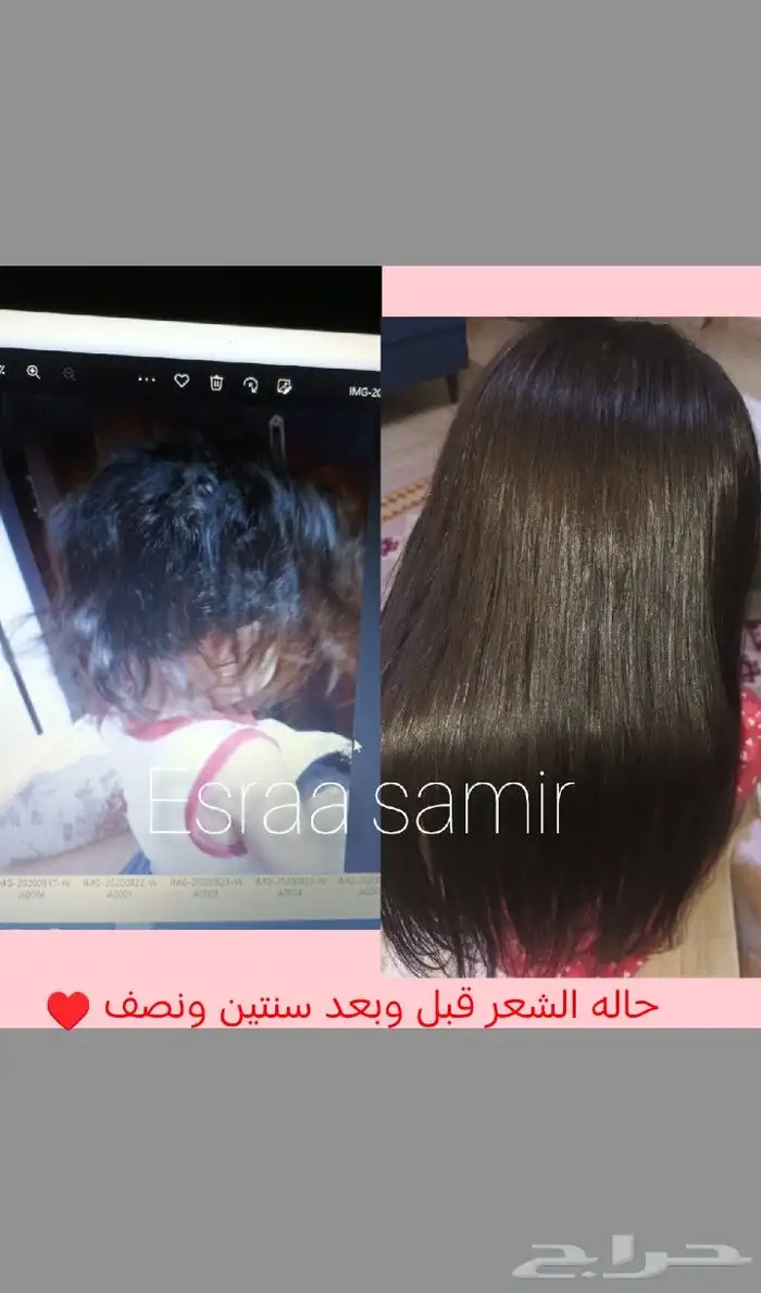 اقوي جلسات تريتمينت للأطفال والكبار نعومه لمعا 0