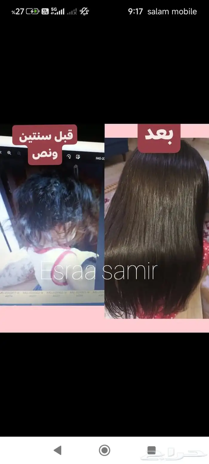 اقوي جلسات تريتمينت للأطفال والكبار نعومه لمعا 1