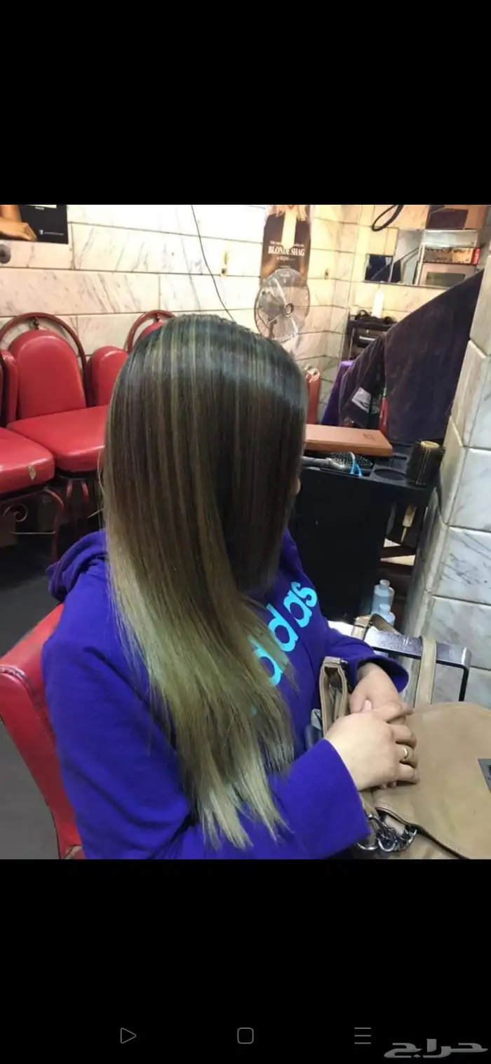 جلسه علاجيه بالفيلر والكافيار والكولاجين 5