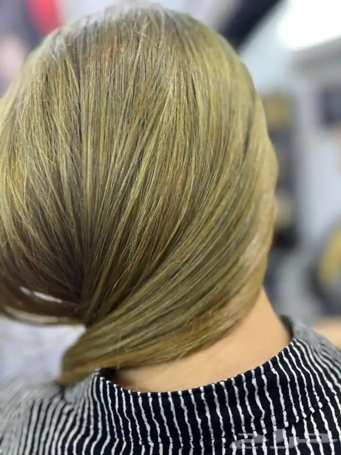 جلسه علاجيه بالفيلر والكافيار والكولاجين 4