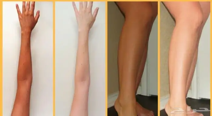 تركيبات تفتيح صيدلانية خاليه من الكرتزون 3