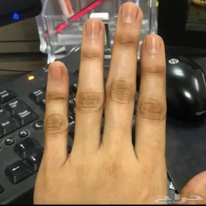 تركيبات تفتيح صيدلانية خاليه من الكرتزون 4