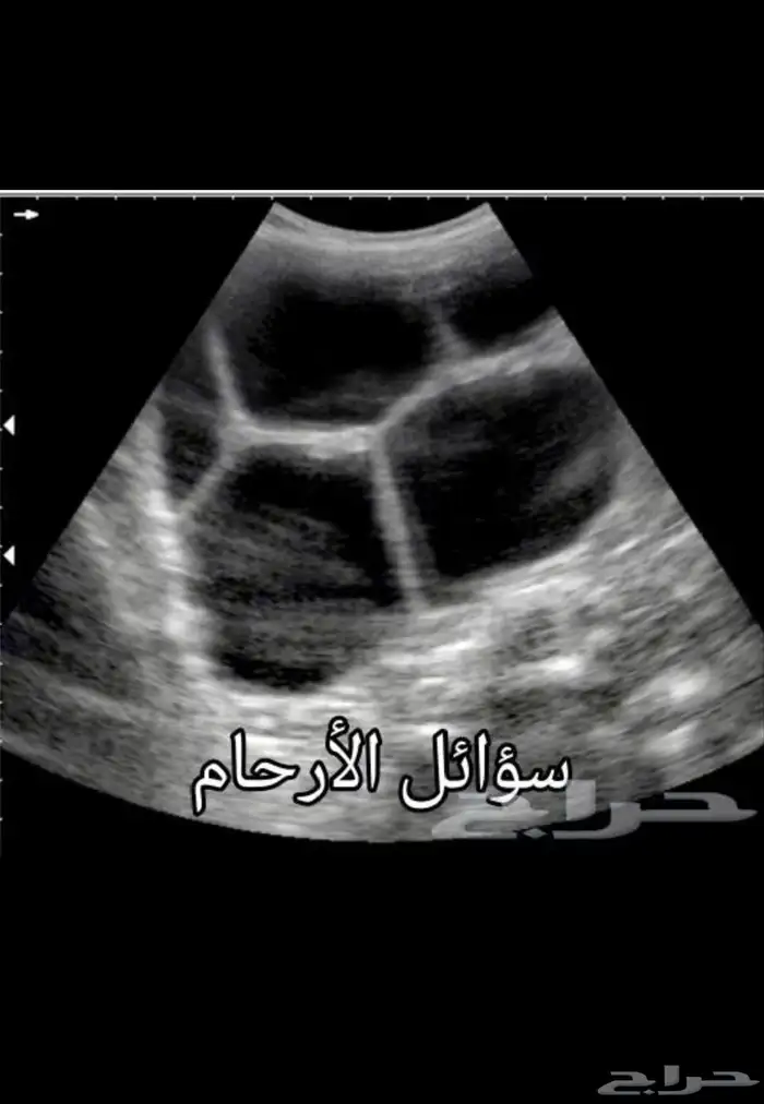 سونار اغنام 0