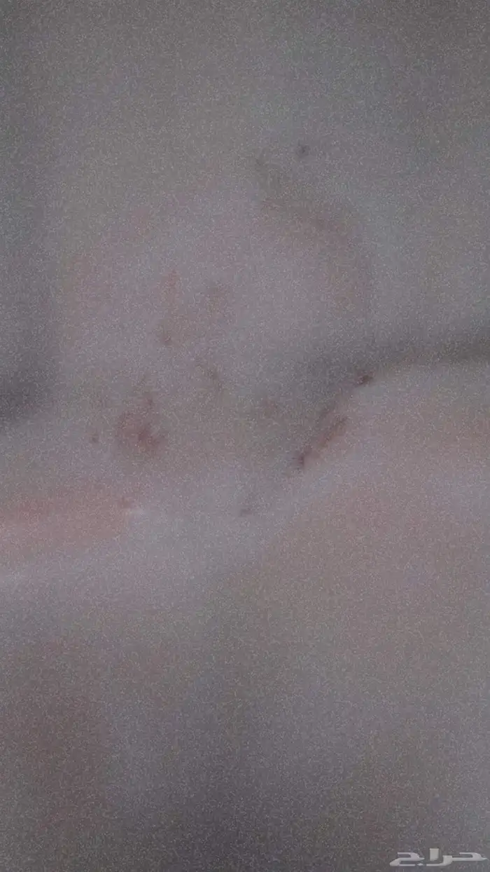 لحام خزانات بلاستيك مكسوره علا الضمان نفس الماده البولي اثل 5