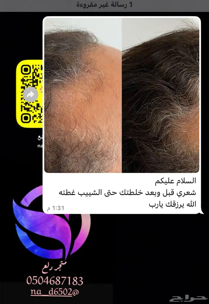 زيت افغاني زيت نواه التمر زيت مشاط احمر 8