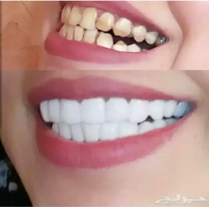 سناب اون سمايل 1