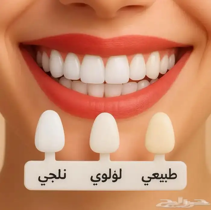 سناب اون سمايل 3