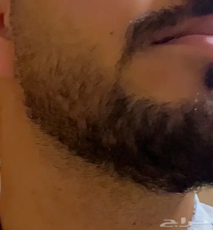 منتج منبت للشعر و علاج للثعلبه 2