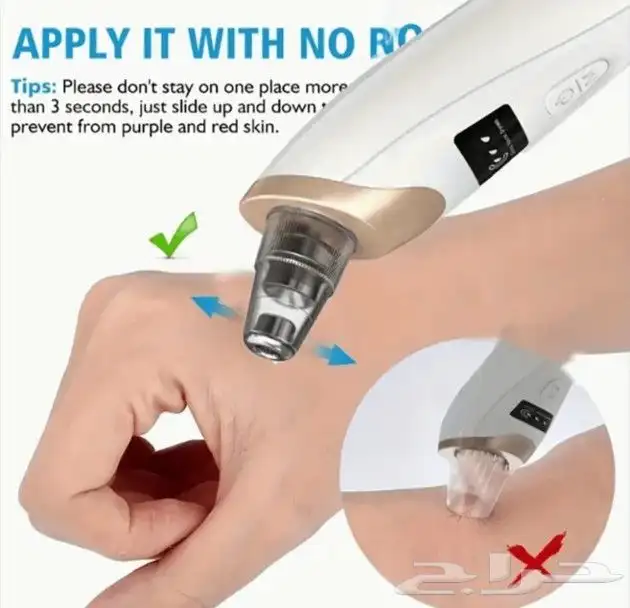 جهاز تنظيف الرؤوس السوداء والمسام 5