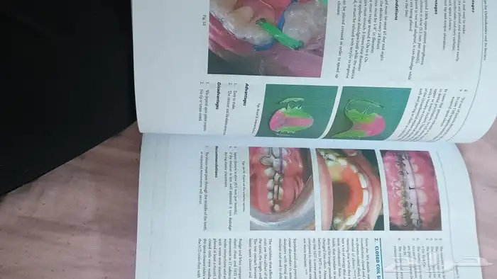 كتب طب اسنان تقويم وزماله بريطانيه بالالوان 0
