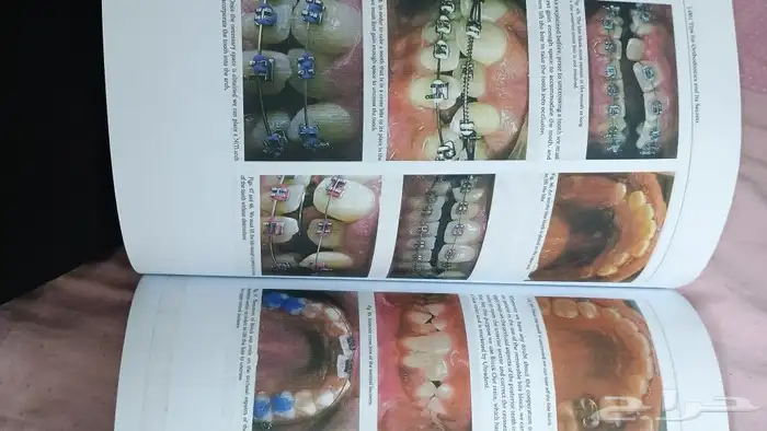 كتب طب اسنان تقويم وزماله بريطانيه بالالوان 1