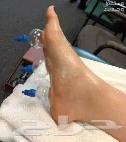 ابو عبدالله الخوارزمي للحجامة والمساج وفك الابهر 10