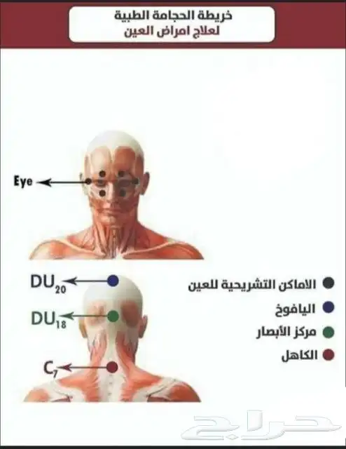 ابو عبدالله الخوارزمي للحجامة والمساج وفك الابهر 2