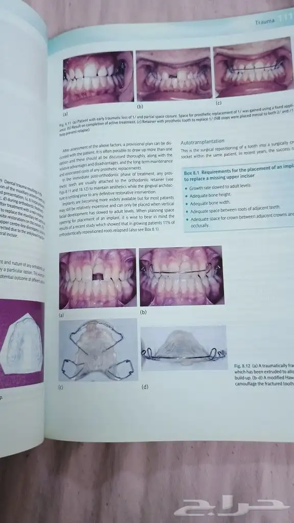 كتب طب اسنان تقويم وزماله بريطانيه بالالوان 3