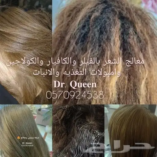 متخصصه علاجيه للشعر 0