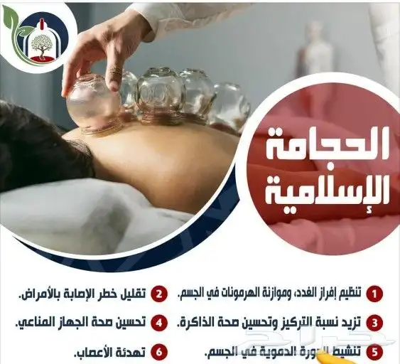 متخصص حجامه منزليه خبره اكثر من 5 سنوات 0