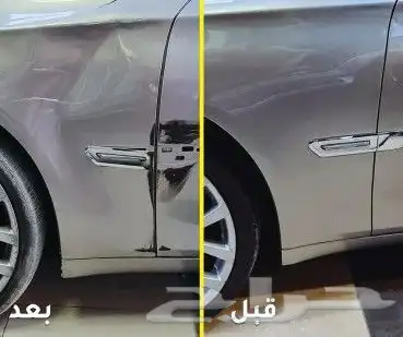 شفط وتعديل بدون صبغ 4